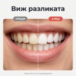 Избелваща писалка PAP+ — по-бяла усмивка за 10 минути, където и да си - Image 5